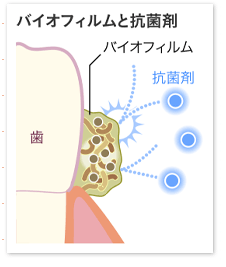 歯垢バイオフィルム