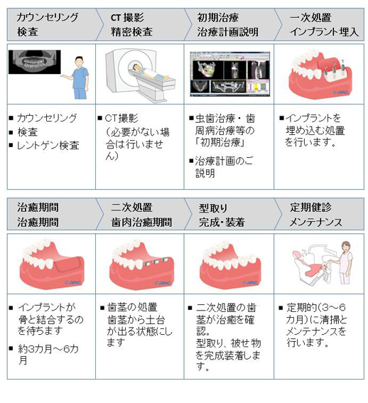 インプラント治療の流れ.jpg