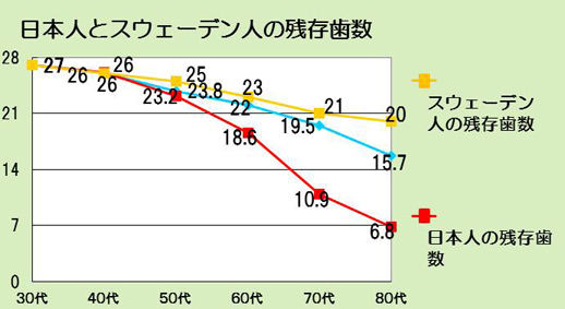 歯周病予防の実際 - 大阪箕面市の歯医者 ながせ歯科 無痛治療